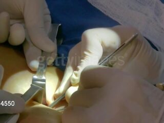 ए जे ली से wwe हो जाता है उसकी third स्तन implant: फ्री अडल्ट चलचित्र 8e